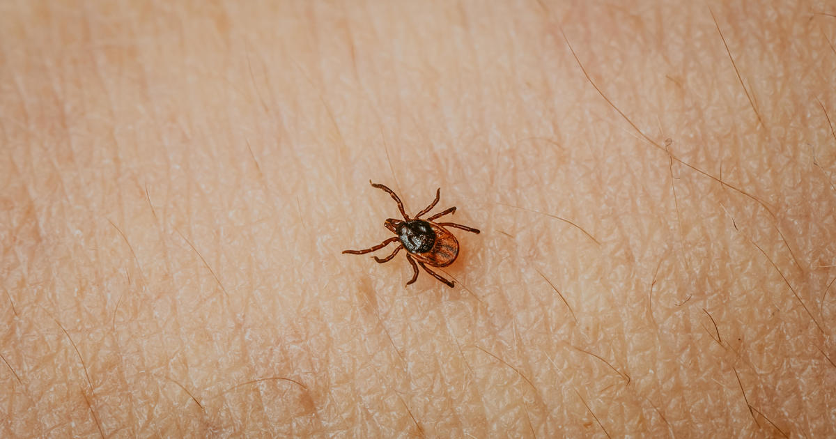 Are ticks worse this year? Tips on how to avoid them CBS Boston