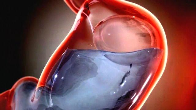 health-0122-healthwatch-330-640x360.jpg