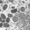 U.S. officials announce more steps to combat monkeypox outbreak