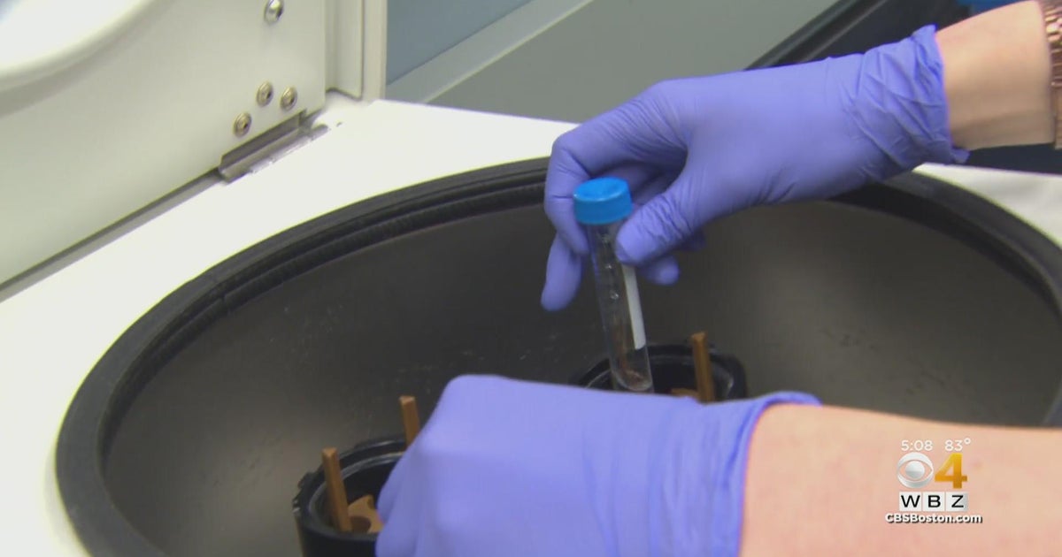 Many wonder how Roe v. Wade will affect fertility treatments like IVF CBS Boston