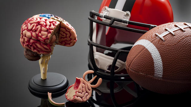 Brain damage and sports injury concept 