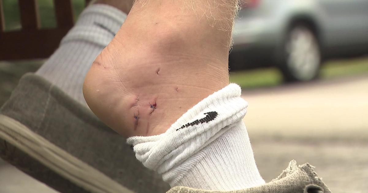 17-year-old lifeguard bitten by shark during training off Ocean Beach ...