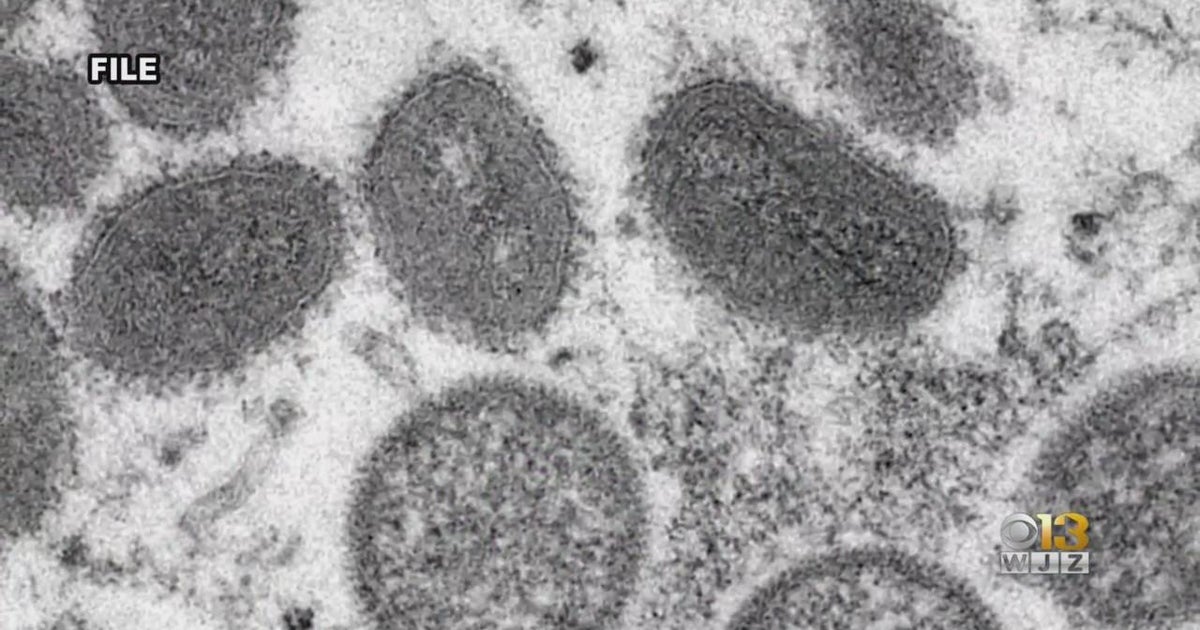 Maryland Now Has 15 LabConfirmed Cases Of Monkeypox CBS Baltimore