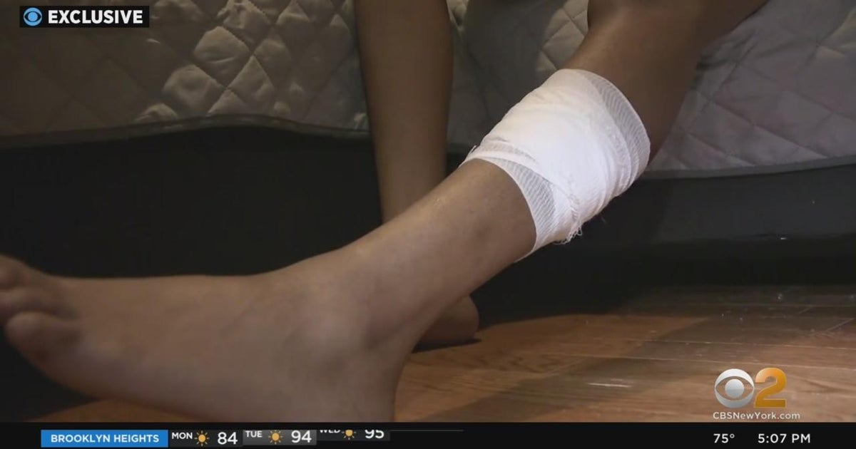 Bronx woman shot in leg while walking dog - CBS New York