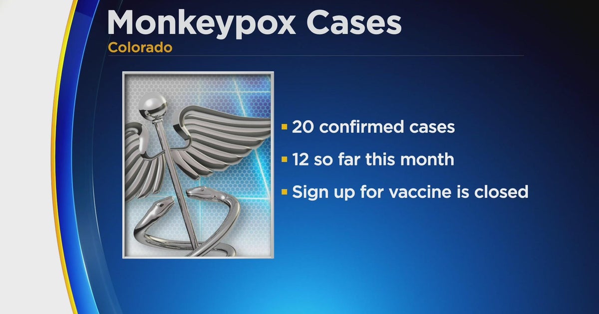 Monkeypox cases continue to rise in Colorado - CBS Colorado