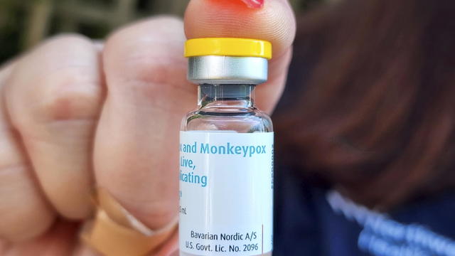 A vial of the Monkeypox vaccine 