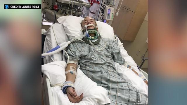 A man lies in a hospital bed with a neck brace on and hooked up to a ventilator. 