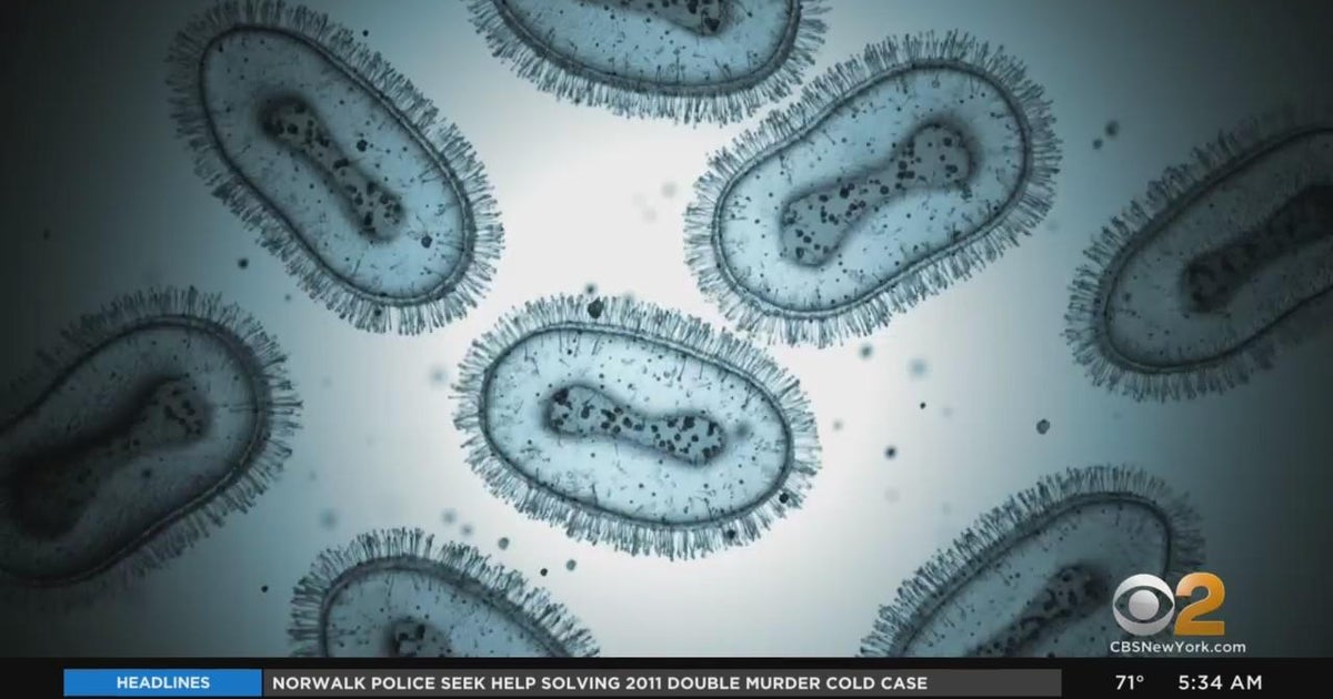 NYC health officials looking to rename monkeypox as cases rise - CBS New York