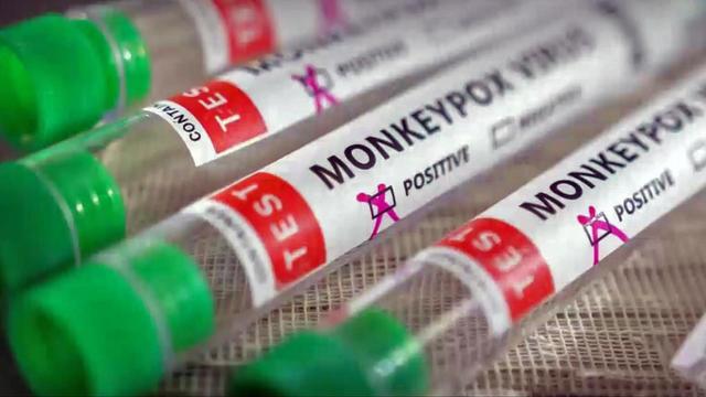 Monkeypox Vaccine 