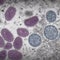 Texas confirms first death of a U.S. monkeypox patient