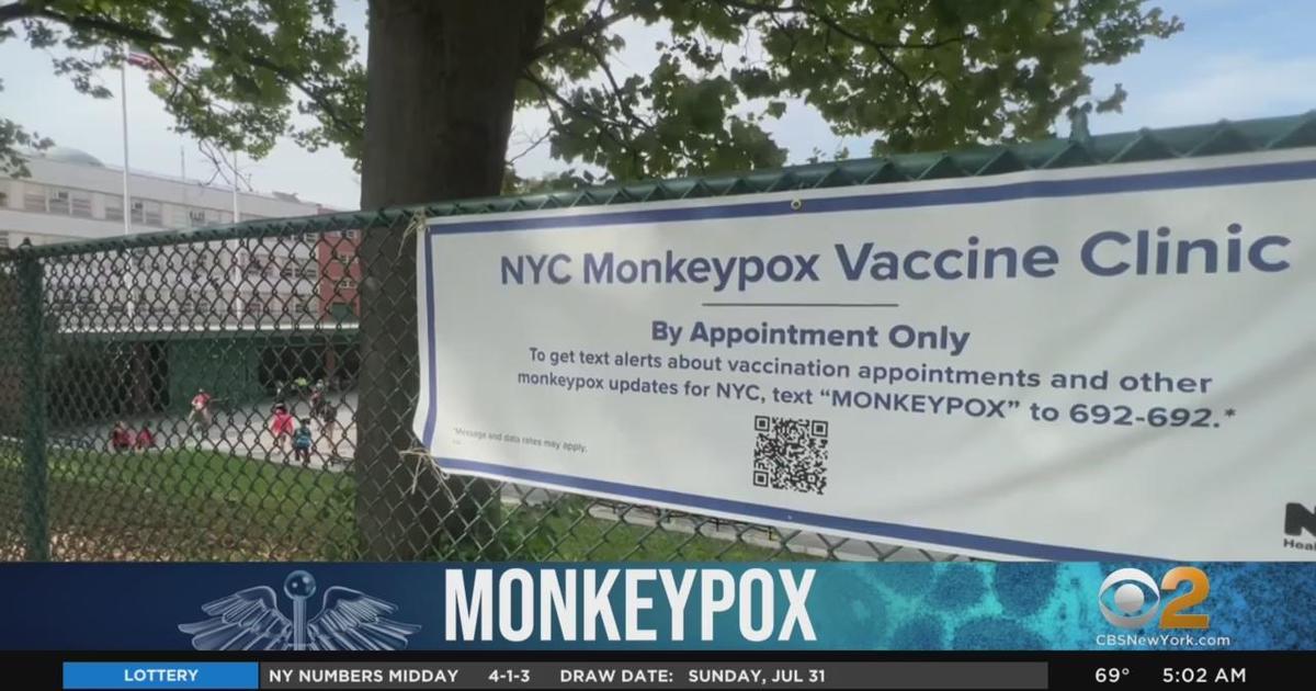 New York Declares Monkeypox Outbreak An Emergency - CBS New York