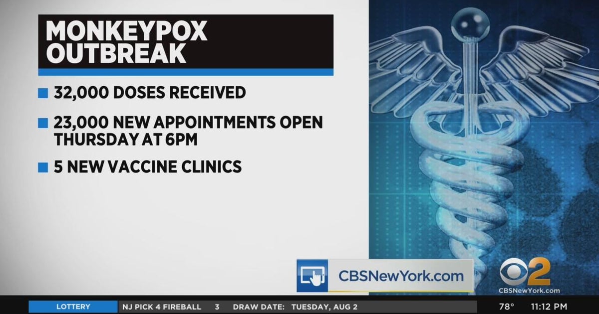 More NYC monkeypox vaccine appointments go online Aug. 4 - CBS New York