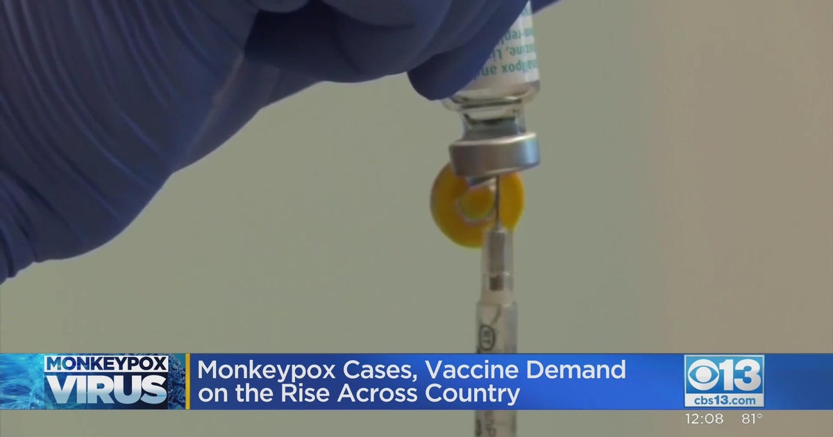 Monkeypox cases, vaccine demand on the rise across US