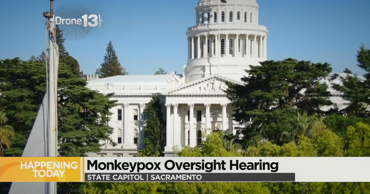 California lawmakers to hold monkeypox oversight hearing