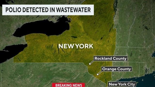 cbsn-fusion-polio-detected-in-new-york-city-wastewater-thumbnail-1195078-640x360.jpg 
