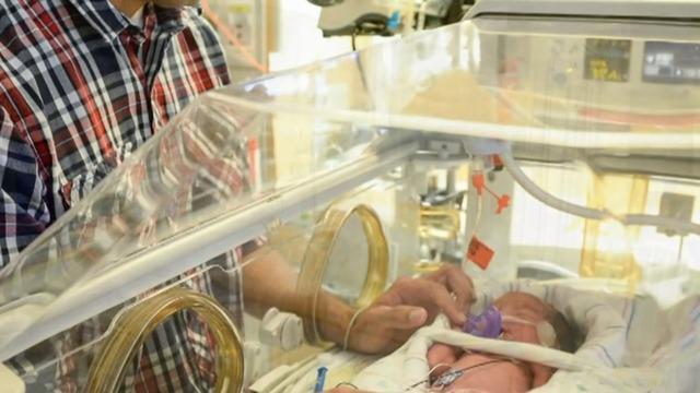cbsn-fusion-new-study-aims-to-provide-equity-for-extremely-preterm-infants-thumbnail-1204401-640x360.jpg 