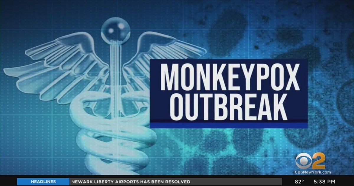 Health officials: 442K monkeypox vaccine doses available - CBS New York