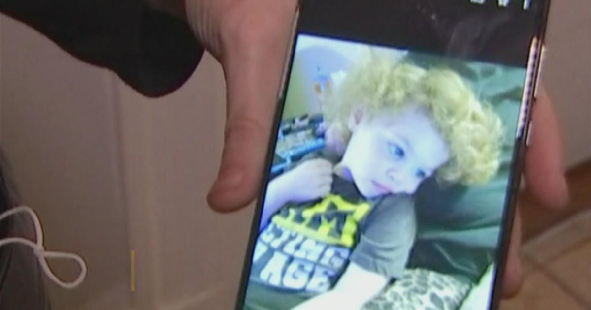 Boy who fell out of Dorchester window last week has died - CBS Boston