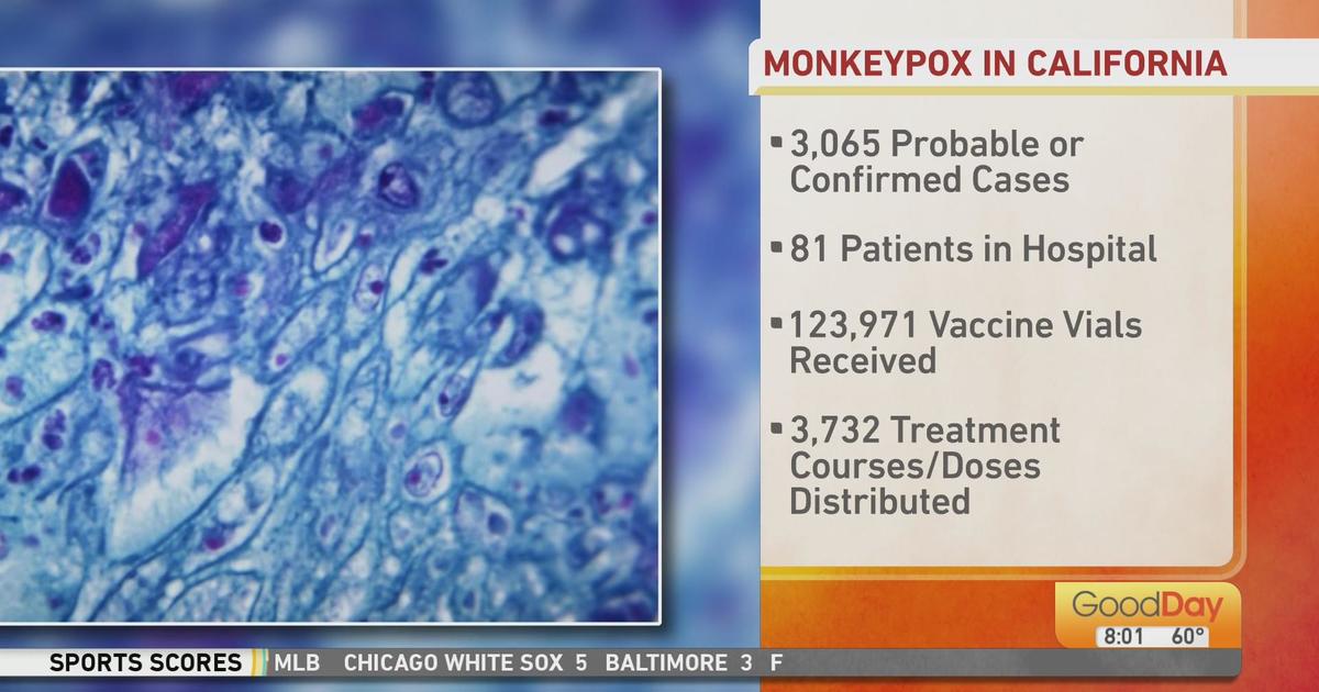 More than 3,000 monkeypox cases now reported in California Good Day