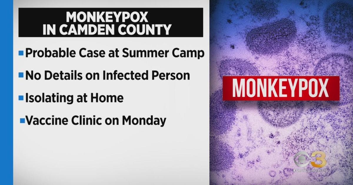 Probable monkeypox case identified at Camden County summer camp CBS