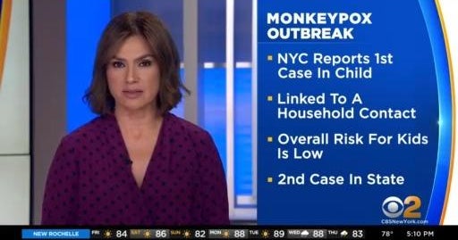 First case of monkeypox in child reported in New York City - CBS New York