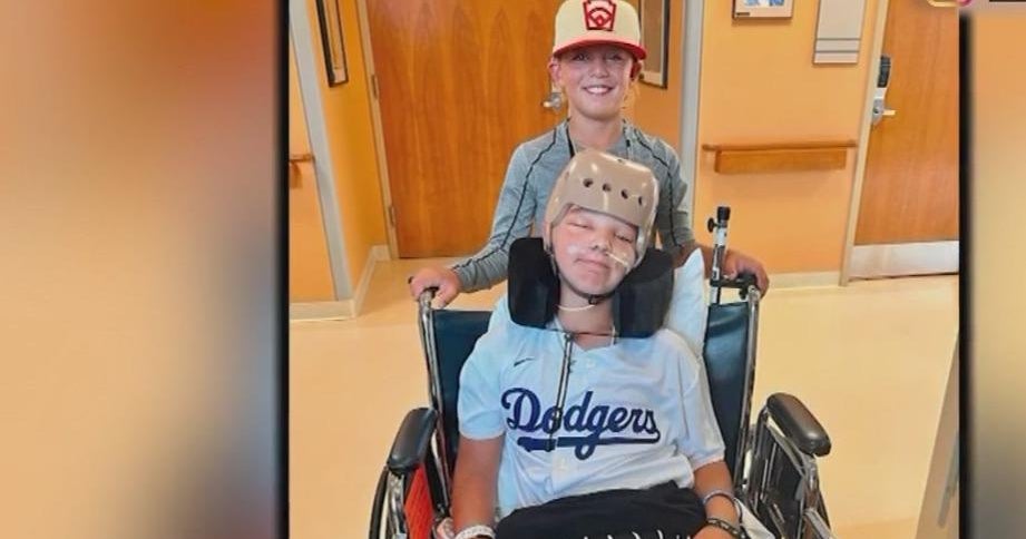 Utah Little League Player Continues To Recover After Falling From Bunk Bed In Williamsport Cbs Utah Little League Player Continues To Recover After Falling From Bunk Bed In Williamsport Cbs