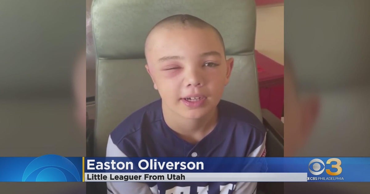 Little Leaguer Who Was Injured After Fall From Bunk Bed In Williamsport Is Back In Utah Cbs Little Leaguer Who Was Injured After Fall From Bunk Bed In Williamsport Is Back In Utah Cbs