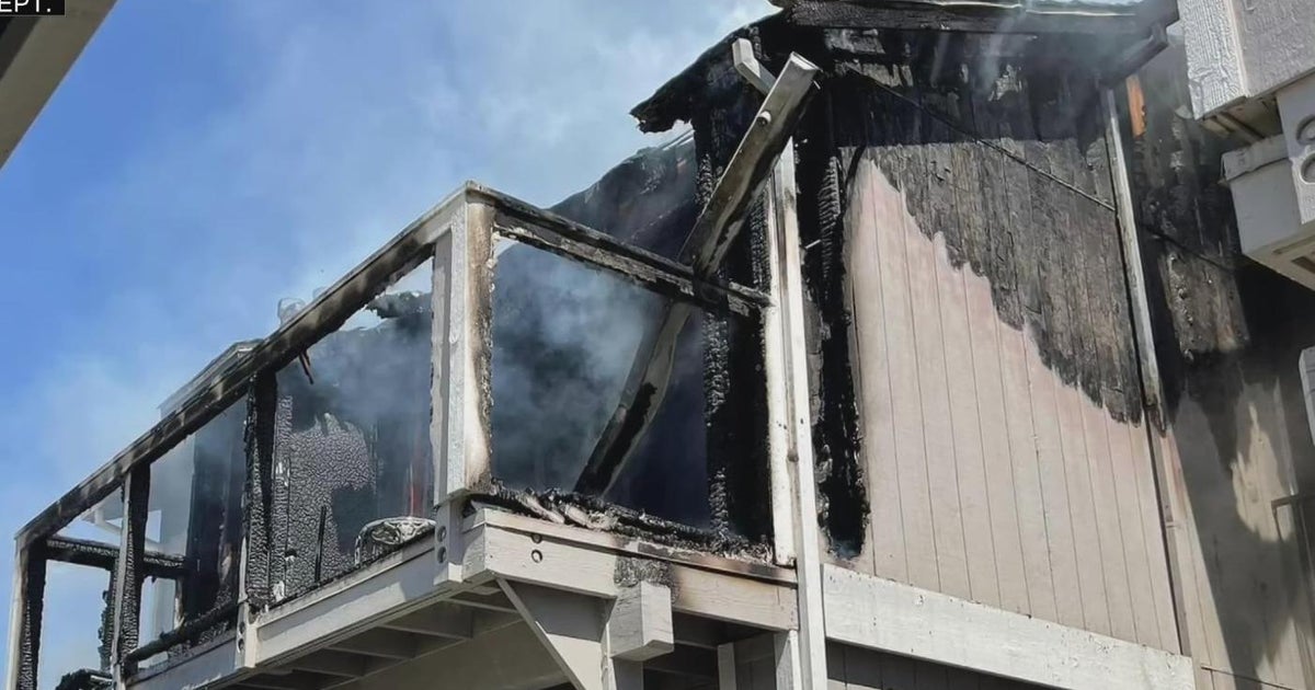 Firefighter recovering from injuries received while fighting a Vacaville fire