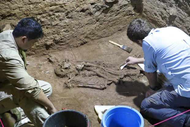 Stone Age skeleton's missing foot likely evidence of prehistoric surgery