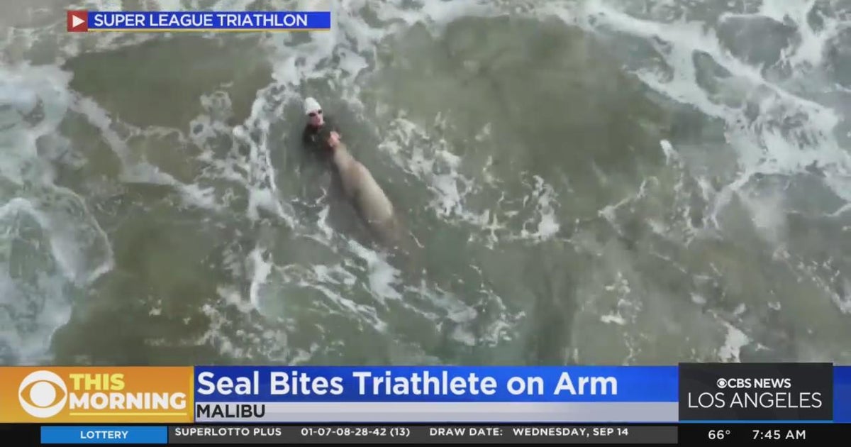 Seal bites triathlete on arm in Malibu CBS Los Angeles