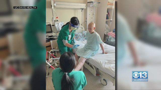 UC Davis Health doctor helps save 11-year-old girl's leg 