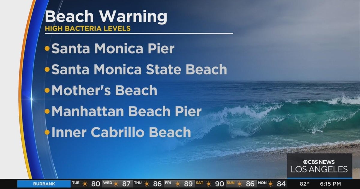 Health officials issue warning - 5b155e2cfa18f046db0cb13394c9c37f 