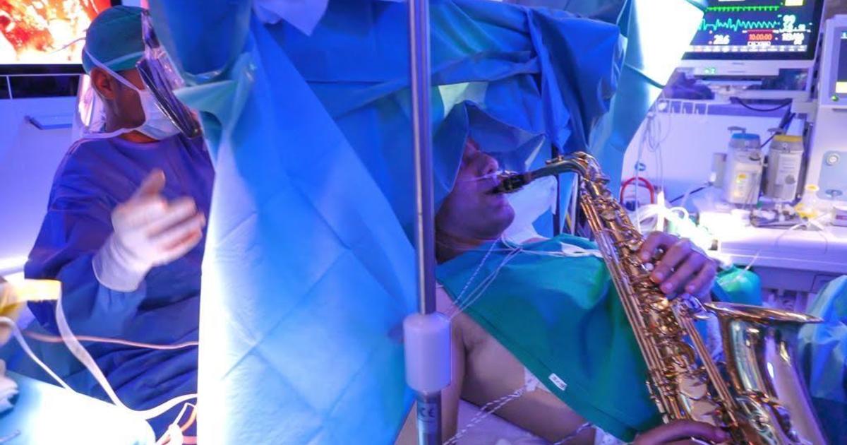 رجل يعزف على الساكسفون أثناء جراحة الدماغ المعقدة التي استمرت 9 ساعات لإزالة ورم