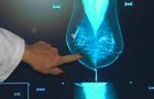 cbsn-fusion-breast-density-awareness-is-key-in-early-cancer-detection-thumbnail-1405402-640x360.jpg 