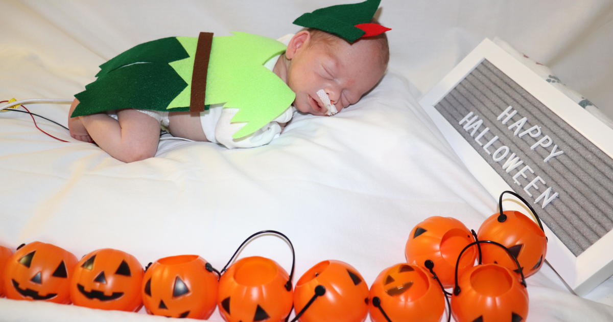 Enjoy these photos of tiny babies at Methodist Dallas and other kids in  costume for Halloween