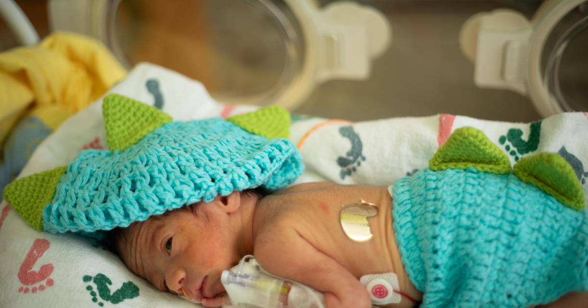 USA Today  These tiny babies in tiny costumes in NICU will melt your heart  — Schaumburg Photography