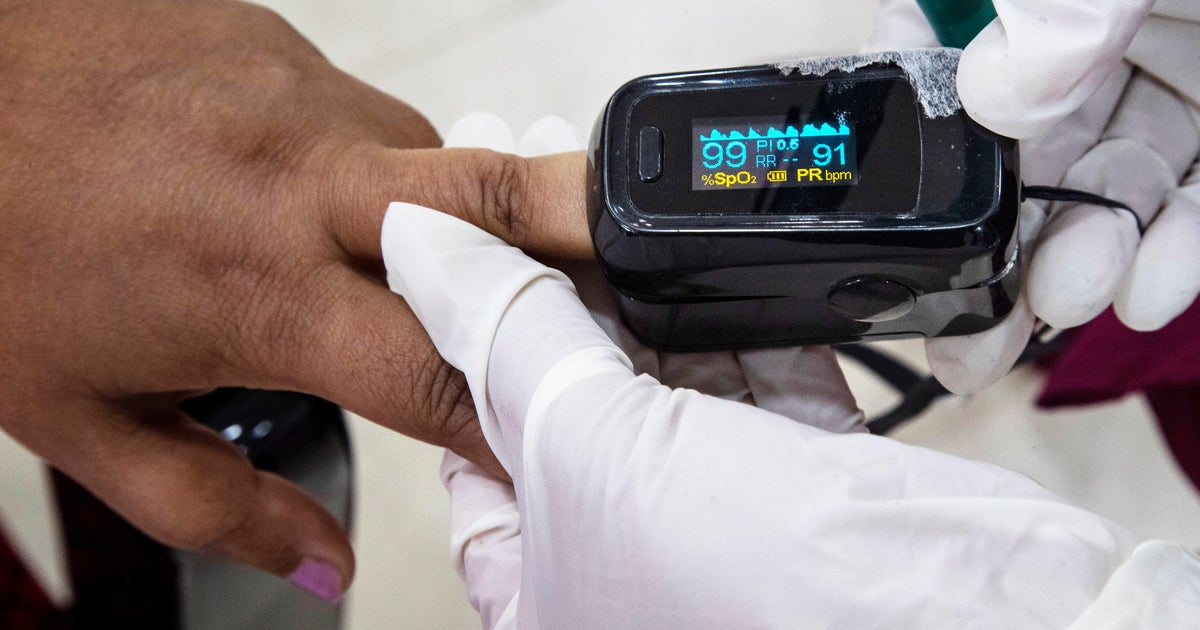 FDAs promised rules on pulse oximeters unlikely to end decades of racial bias  CBS News FDAs promised rules on pulse oximeters unlikely to end decades of racial bias  CBS News