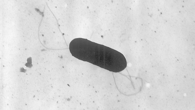 This 2002 electron microscope image made available by the Centers for Disease Control and Prevention shows a Listeria monocytogenes bacterium, responsible for the food borne illness listeriosis. 