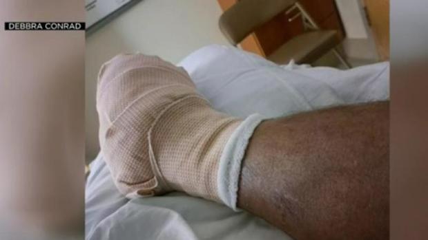 injured foot 