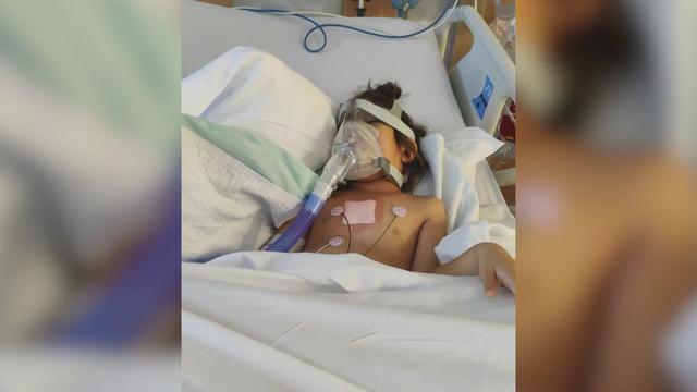 A 3-year-old girl lays in a hospital bed, wearing a breathing mask. 