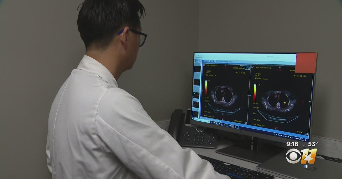 New treatment for lung cancer shows promising results for one local family - Vimarsana News