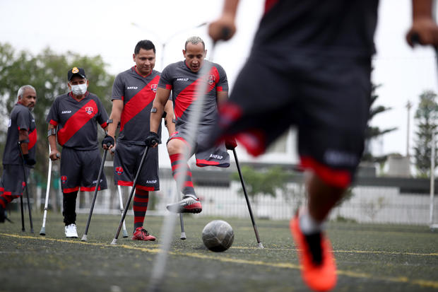 Peru's First Amputee Football Team Seeks a Place in the World Cup 