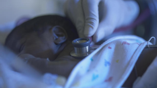 African American premature baby being examined 
