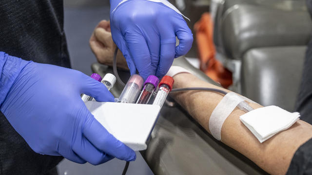 American Red Cross has a critical shortage of blood 