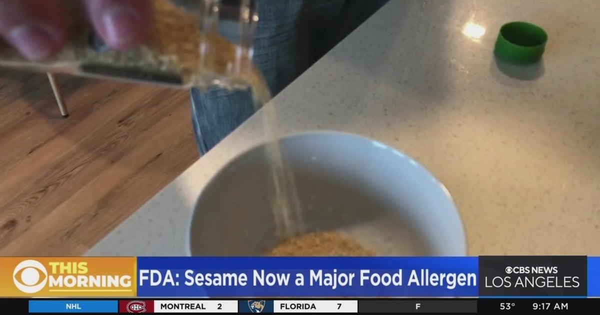 FDA adds sesame to the official food allergen list CBS Los Angeles