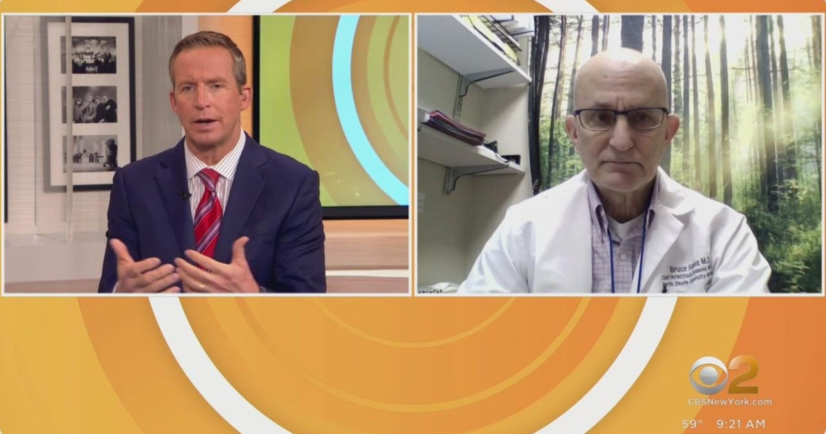 CDC tracking new COVID variant - CBS New York