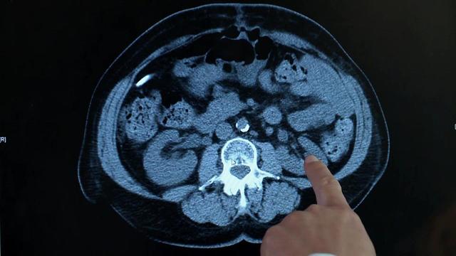 A doctor looks at a medical scan. 