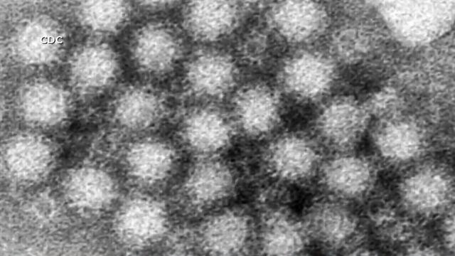 norovirus.jpg 