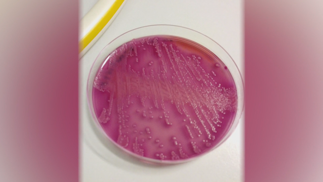 16pkg-ss-bacteria-in-puddles-01-frame-1613.png 