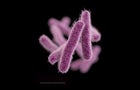 Imported Superbug 